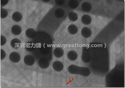 BGA因為焊墊變小，造成錫膏過多而最終形成焊接短路的結(jié)果。